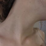 Side view of neck