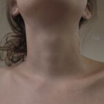 Windpipe