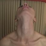 Windpipe
