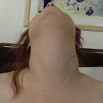 Person with head tilted back