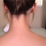 Nape